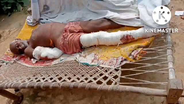 गाय चराने के विवाद में मारपीट में जख्मी वृद्ध नकुल राय की इलाज के दौरान हुई मौत पत्नी का इलाज जारी