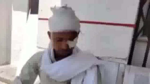 नकहीं में मामूली कहासुनी में भिड़े दो पक्ष एक घायल अस्पताल में किया गया इलाज