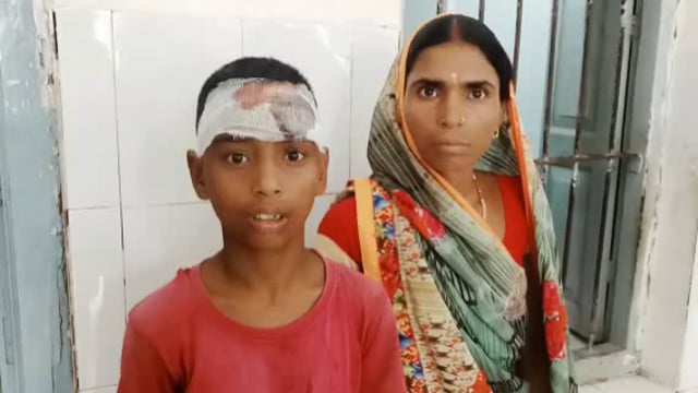 महुलान गांव में ठेका ठेलने को लेकर एक व्यक्ति ने 12 वर्षीय बालक को डंडा से मारकर फोड़ा सर#crime 