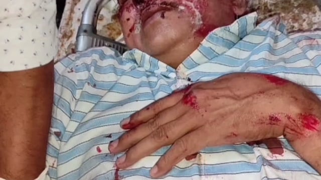 वाहन की टक्कर से अधिवक्ता घायल रिफर