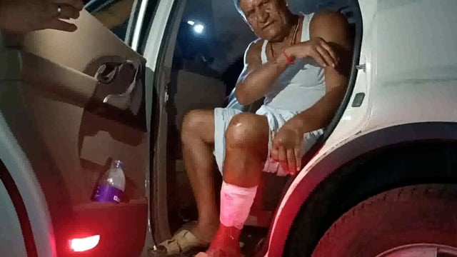 रंगदारी नहीं देने पर ग्रामीणों के द्वारा मारपीट कर किया गया जख्मी