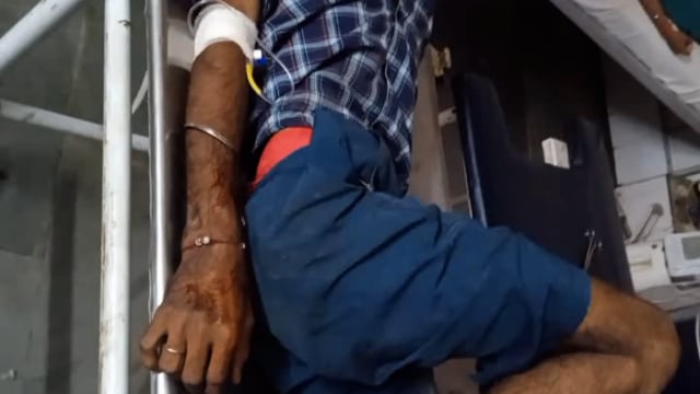 खैर कोतवाली के क्षेत्र में नौझील बाजना मार्ग पर बाइक फिसलने से बाइक सवार हुआ गंभीर घायल