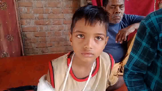 कन्नौज के इंदरगढ़ क्षेत्र के कलशान स्थित पूर्व उच्च माध्यमिक विद्यालय में खेलते समय छात्र का गिरने से हाथ टूटा परिजनो 