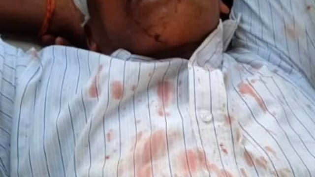 लोहरौला में दबंगो दबंगों ने प्राथमिक विद्यालय के अध्यापक के साथ की मारपीट किया लहूलुहान ।