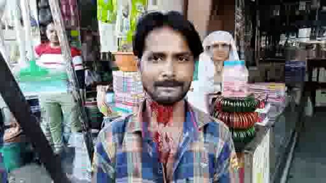  बिधूना कस्बे के मेन मार्केट में दुकानदारों की आपस में हुई जमकर मारपीट कस्बा चौकी इंचार्ज का ढुलमुल रवैया आया सामने