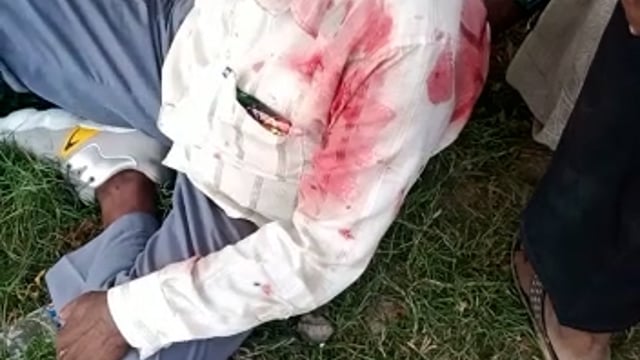 जालौन

फिर दिखा रफ़्तार का कहर
पैतृक गांव पूजा करने जा रहे दम्पत्ति को कार ने मारी जोरदार टक्कर
दोनों हुए घायल
