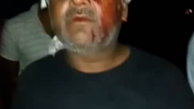 भीखेपुर में बस चालक व सवारियों के साथ हुई मारपीट में जानकारी देता चालक व अन्य