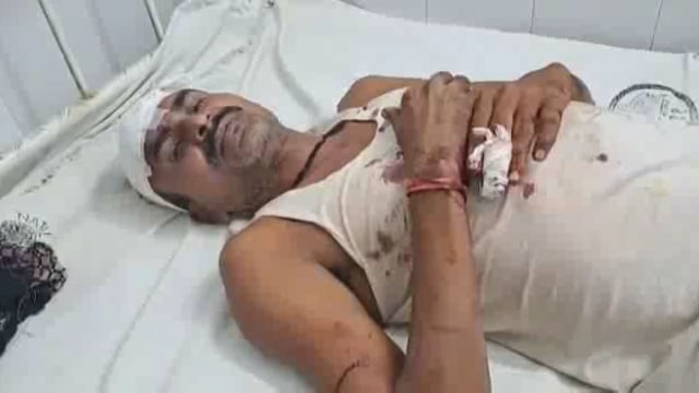 हवेली खड़गपुर बड़ी तिलवरिया गांव में दो पक्षों के बीच जमीनी विवाद को लेकर मारपीट दो घायल,बेहतर इलाज के लिए एक रेफर