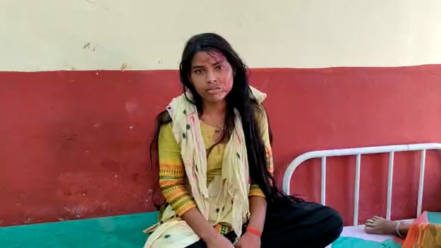 दिबियापुर थाना क्षेत्र के हीरा पुरवा गांव में दबंगों ने किशोरी पर किया जानलेवा हमला वही किशोरी ने छेड़खानी के लगाये आरोप