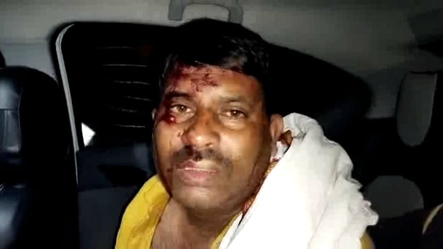 खनन  की सूचना देना युवक को पड़ा भारी युवक पर हुआ जानलेवा हमला#sp auraiya #up police#thana phaphund