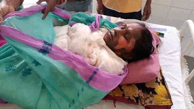 मेदनी चौकी थाना क्षेत्र के खावा राजपुर के शोभा देवी को जलाकर मारने का किया गया प्रयास