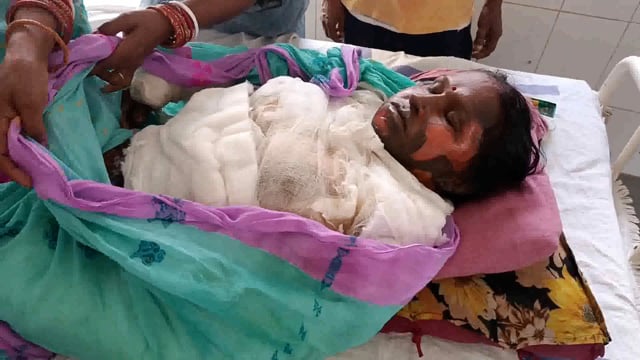 मेदनी चौकी थाना क्षेत्र के खावा निवासी शोभा देवी को जलाकर मारने का किया गया प्रयास