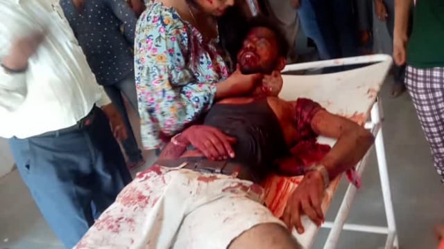 कोरांव थाना क्षेत्र के अंतर्गत पड़रिया गांव का रहने वाले एक व्यक्ति की दिन में ही की गई निर्मम हत्या #korav 