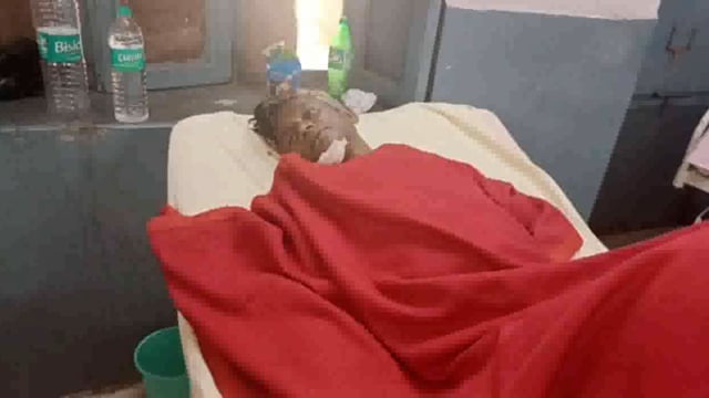 अधिक शराब के सेवन के चलते 50 वर्षीय व्यक्ति रोड पर गिरा राहगीरों ने जिला अस्पताल में कराया भर्ती