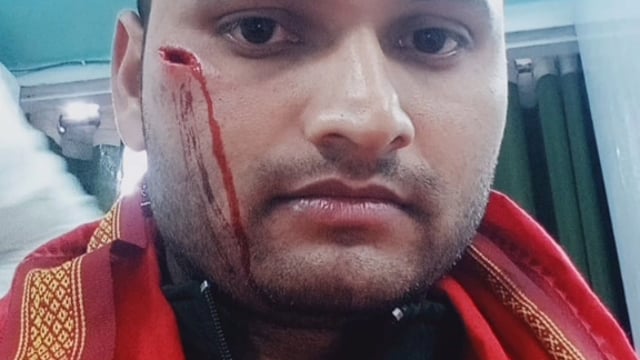 चानन  : बसंतपुर खिलहा गांव में भाई के बीच बटबारे को लेकर मारपीट दो घायल। 