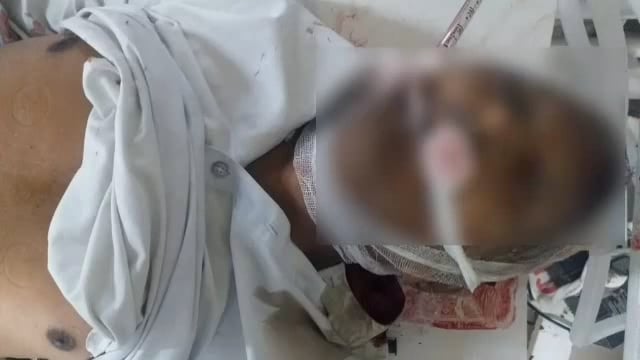 बोधन नगर येथे जखमी अवस्थेत आढळून आलेल्या अनोळखी व्यक्तींचा लातूर येथे उपचारादरम्यान मृत्यू