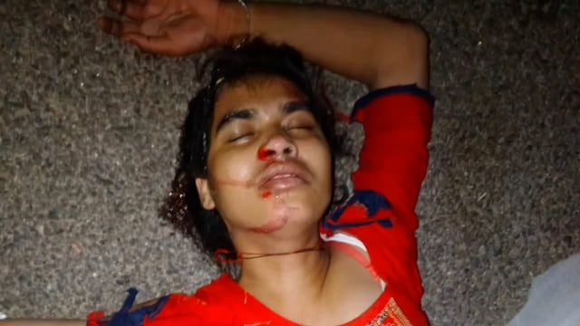 थाना मांट क्षेत्र अंतर्गत यमुना एक्सप्रेस वे के माइलस्टोन 107 पर घायल अवस्था में मिली युवती युवती की नहीं हो सकी पहचान।