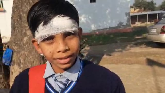 नवाबगंज क्षेत्र के विष्णु हरपुर मुख्य मार्ग पर अनियंत्रित मोटरसाइकिल सवार ने स्कूली छात्र को मारी टक्कर