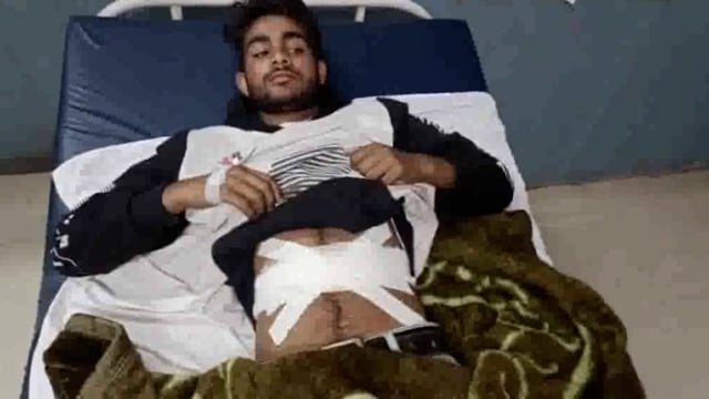 दो पक्षो में हो रहे विवाद के बीच मैं बोलने पर दो युवकों में मारे चाकू गंभीर हालत में जिला अस्पताल में कराया भर्ती