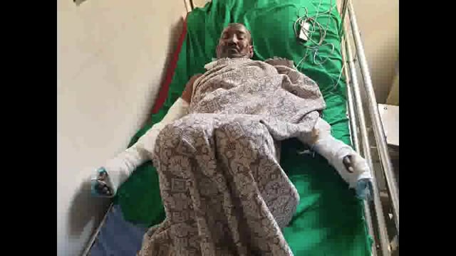 कल्याण के डोंबिवली में गैस वेल्डिंग का पाइप फटने से 3 लोग हुए जख्मी