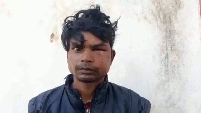 खैर कस्बे में ढकेल पर अंडा खा रहे युवक के साथ की मारपीट किया घायल 