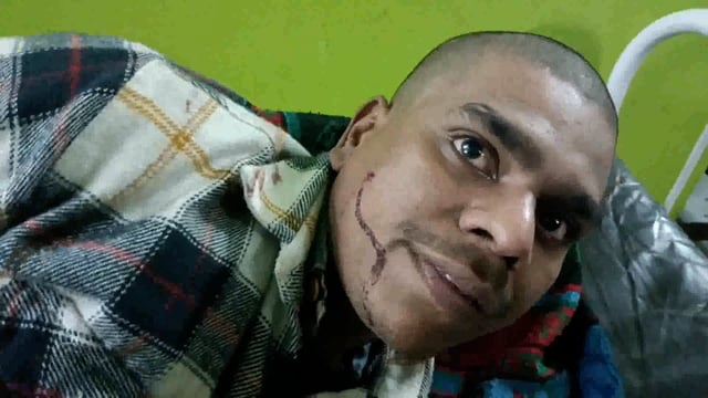 टोटो और बाइक की टक्कर में सूर्यगढ़ा थाना क्षेत्र के मानुचक के दो व्यक्ति हुए घायल