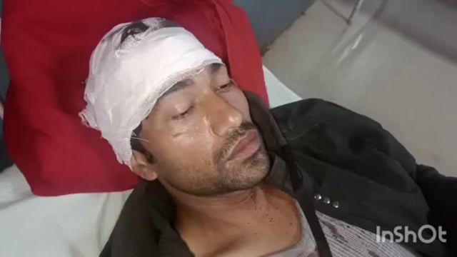 मथुरा थाना मगोर्रा के गांव उम्मीद की नगरिया में भाई भाइयों में हुआ विवाद छोटा भाई व उसकी पत्नी हुए गंभीर रूप से घायल