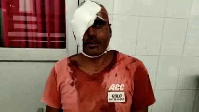 बलरामपुर: धर्मपुर गांव में नाली विवाद में दो पक्षों में जमकर हुआ मारपीट सुनिए क्या कुछ कहता है पीड़ित 