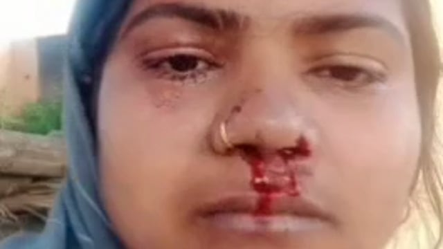 रास्ता विवाद को लेकर सैनिक की पत्नी को मार कर क्या गंभीर रूप से घायल