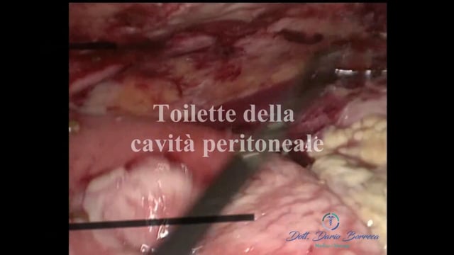 Clicca per riprodurre il video