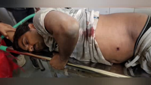 जुंआ का पैसा बंटवारा में विवाद पर चली गोली,  युवकों को लगी गोली, जिला अस्पताल से प्रयागराज रेफर
एसपी सतपाल अंतिल का बयान