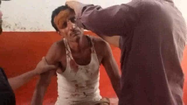 लौगाय गांव में भूमि विवाद को लेकर दो पक्षों में हुआ मारपीट कुल 8 लोग हुए गंभीर रूप से जख्मी