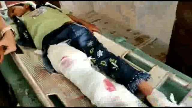 जसपुरा के पास में तेज रफ्तार गति से जा रहे मैजिक गाड़ी वाले ने दो बाइकों में मारी टक्कर,6 हुए घायल