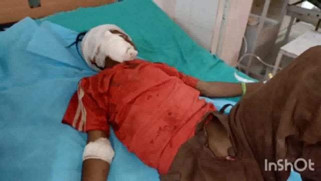 गोवर्धन में ई-रिक्शाओ का आतंक ई-रिक्शा की टक्कर लगने से घायल हुआ 10 वर्षीय मासूम जिला अस्पताल किया रैफर