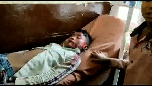 भाथा गांव के पास में अज्ञात वाहन ने पैदल जा रहे दो सगे भाइयों को मारी जोरदार टक्कर,दोनों अस्पताल में भर्ती