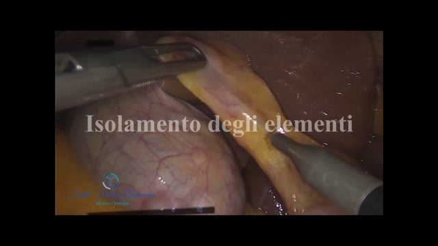 Clicca per riprodurre il video