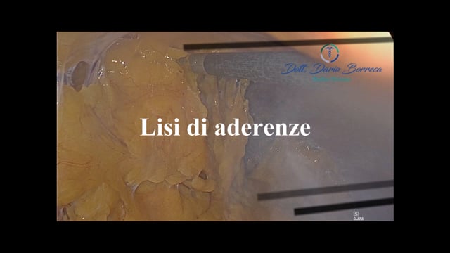 Clicca per riprodurre il video