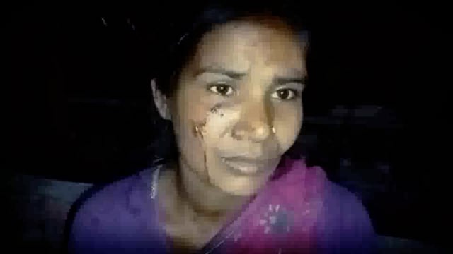 इंग्लिश गांव में बच्चों के बीच हुए विवाद को लेकर पति पत्नी को मारपीट कर किया जख्मी