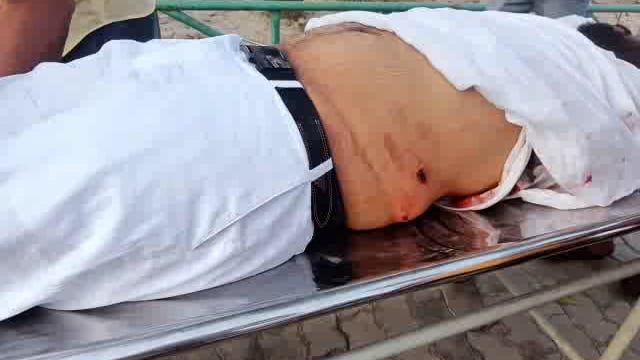 दिन दहाड़े युवक को मारी गोली, क्षेत्र में फैली सनसनी
मौके पर पहुंचे ASP, CO, SHO समेत भारी पुलिस बल
पुलिस जाँच जारी