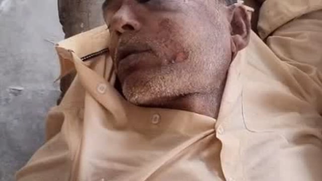 घायल अवस्था में मिला अज्ञात व्यक्ति अभी तक नहीं आया होश CHC इटवा में भर्ती