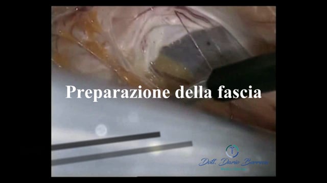 Clicca per riprodurre il video
