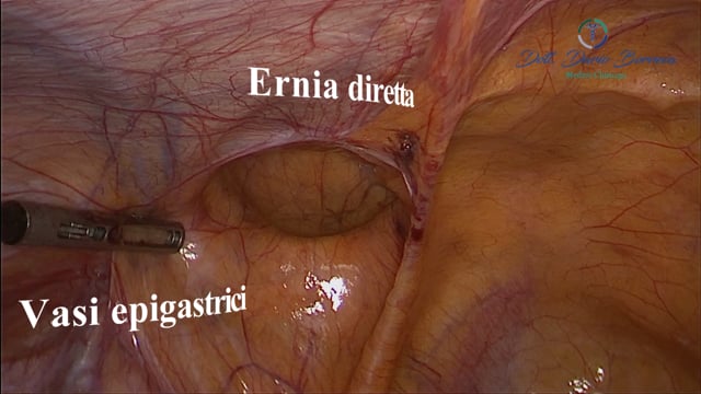 Clicca per riprodurre il video