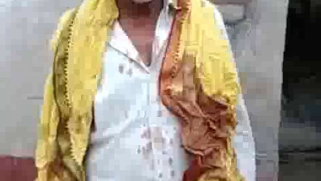 इक्कीसवीं शदी मे भी गरीब गुलामी की जंजीरों मे जकड़ा हुआ, गुलामी से इनकार करने पर आरोपी ने किया लहूलुहान
थाना लालगंज