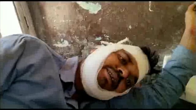 रामपुर गांव में आम तोड़ने के विवाद में पारिवारिक आपस में भिड़े,मामला दर्ज