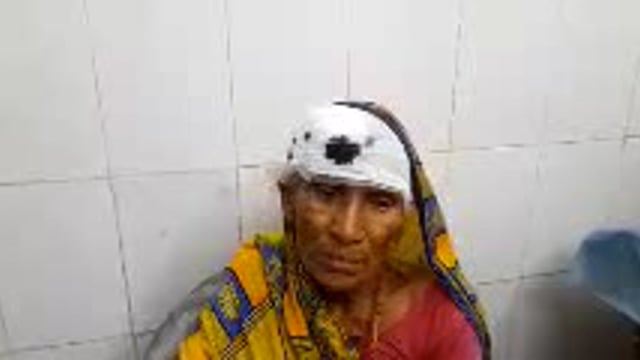 एकरामा गांव में दो पक्षों  में हुई मारपीट एक वृद्ध महिला  घायल।