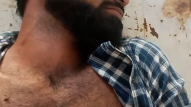 श्रद्धालुओं की कार पोल से टकराई एक की हुई दर्दनाक मौत दो गंभीर रूप से घायल