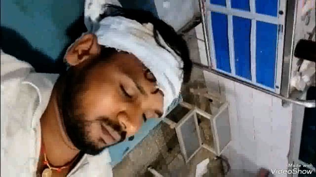 परना डाबर थाना क्षेत्र के सांढ़ मंझगावां पंचायत के हर नारायणपुर गांव में हुई मारपीट की घटना में 3 लोग हुए जख्मी