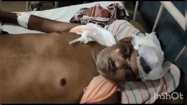 चंदनवन के समीप बाइक टेंपो की हुई भिड़ंत दो घायल 1 गंभीर को आगरा किया रेफर