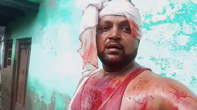 सुरीर कोतवाली क्षेत्र के हरनोल गांव में भाइयों ने भाई को किया मारपीट के गंभीर रूप से घायल हुआ लोहू लुहान