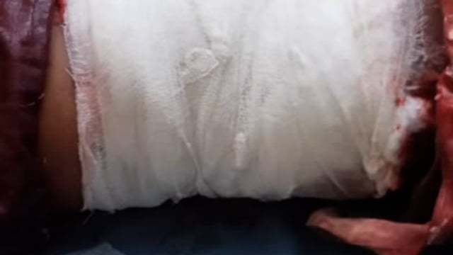 जमीन बंटवारे को ले दो पक्षों में खूनी संघर्ष,धारदार हथियार से हमला,सीएचसी संग्रामगढ़ से रेफर
पुलिस जाँच पड़ताल में जुटी